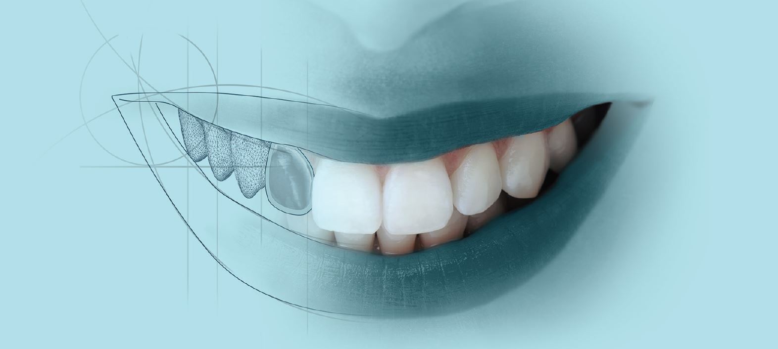 Digital Aesthetics and Digital Dentistry
